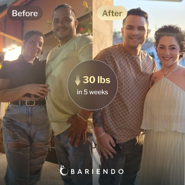 Before and after images of Rey who lost 30 pounds in 5 weeks after an ESG procedure with Bariendo