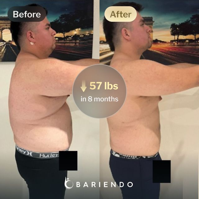Before and after images of Javier who lost 57 pounds in 8 months after an ESG procedure