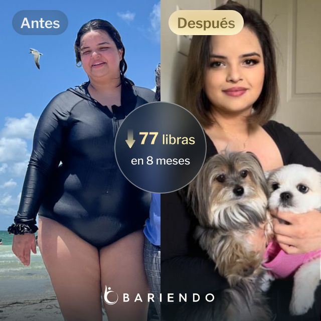 Imágenes de antes y después de Nicole, una paciente de Bariendo ESG que se endurece el estómago y que pierde 77 libras en 7 meses