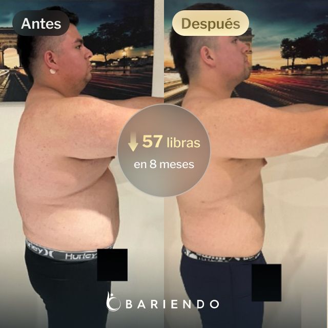 Imágenes de antes y después de Javier que perdió 57 libras en 8 meses después de un procedimiento ESG