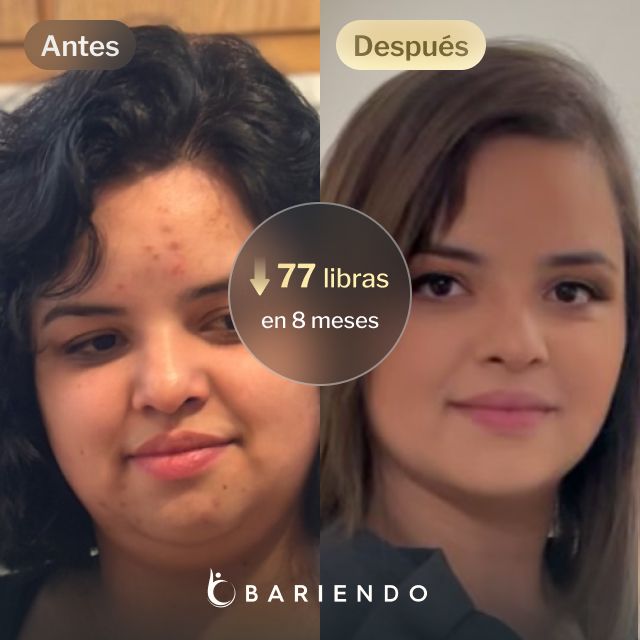 Imágenes de antes y después de Nicole, una paciente de Bariendo ESG que se endurece el estómago y que pierde 77 libras en 7 meses