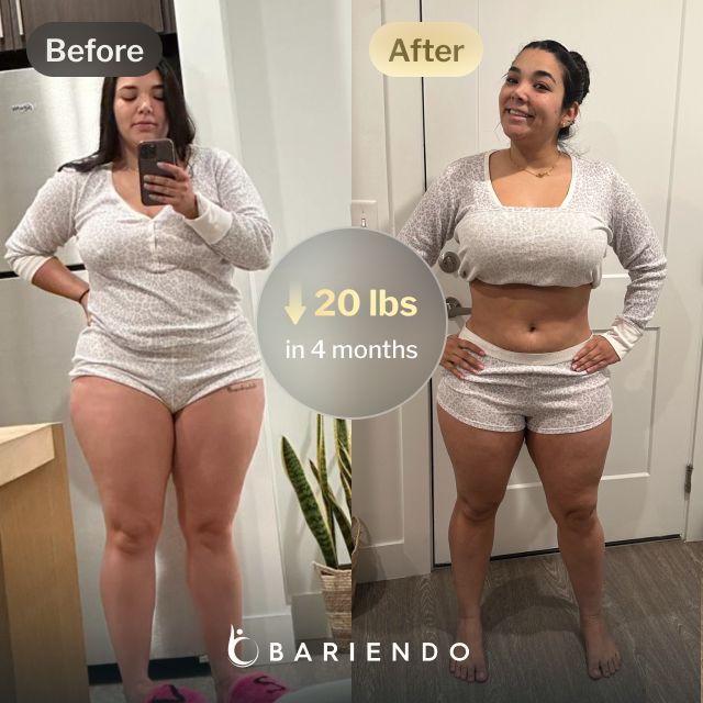 Before and after image of Ruxibeth who lost 20 pounds in 4 months with a gastric balloon procedure